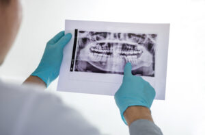 Dentist in gloves examining a panoramic dental X-ray film