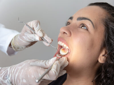 dental cleaning