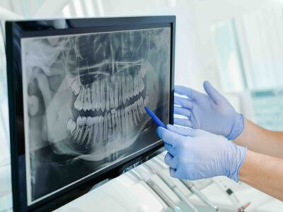 Gloved hands pointing to a panoramic dental X-ray on a monitor