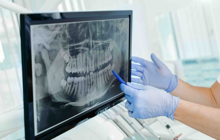 Gloved hands pointing to a panoramic dental X-ray on a monitor